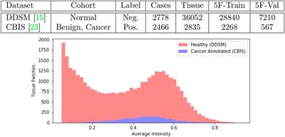High Precision Mammography Lesion Identification From Imprecise Medical Annotations